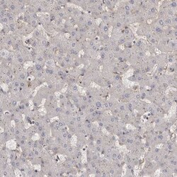 Mena Antibody, Novus Biologicals 0.1mL; Unlabeled:Antibodies, Polyclonal