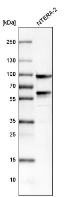 Mena Antibody, Novus Biologicals 0.1mL; Unlabeled:Antibodies, Polyclonal