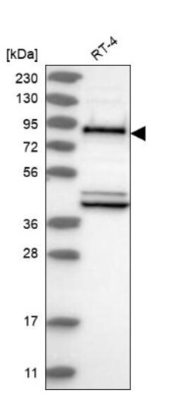 Mena Antibody, Novus Biologicals 0.1mL; Unlabeled:Antibodies, Polyclonal