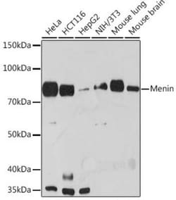 Menin Rabbit anti-Human, Mouse, Rat, Clone: 5M7L9, Novus Biologicals:Antibodies:Primary