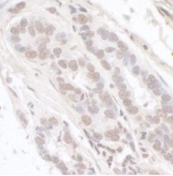 Menin Antibody, Novus Biologicals 0.1mg; Unlabeled:Antikroppar