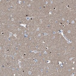 Menin Antibody, Novus Biologicals 25 &mu;L; Unlabeled:Antibodies, Polyclonal