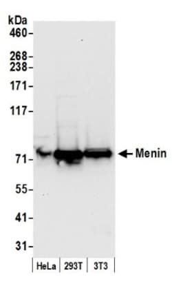 Menin Antibody, Novus Biologicals 0.1mg; Unlabeled:Antikroppar