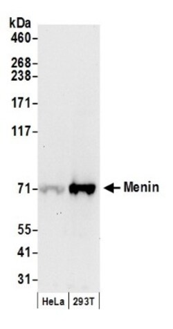 Menin Antibody, Novus Biologicals 0.1mg; Unlabeled:Antibodies, Polyclonal