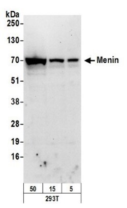 Menin Antibody, Novus Biologicals 0.1mg; Unlabeled:Antibodies, Polyclonal