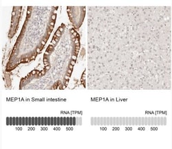 Meprin alpha Subunit/MEP1A Antibody, Novus Biologicals 25 &mu;L | Buy Online | Novus Biologicals | Fisher Scientific