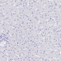 Meprin beta Subunit/MEP1B Antibody, Novus Biologicals:Antibodies:Primary