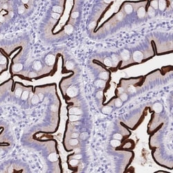Meprin beta Subunit/MEP1B Antibody, Novus Biologicals:Antibodies:Primary