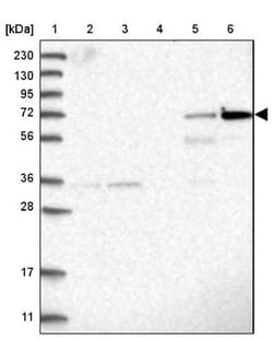 Meprin beta Subunit/MEP1B Antibody, Novus Biologicals:Antibodies:Primary