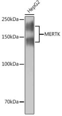 Mer Rabbit anti-Human, Clone: 4I1P7, Novus Biologicals 20 &mu;g | Buy Online | Novus Biologicals | Fisher Scientific