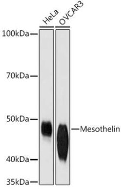 Mesothelin Rabbit anti-Human, Rat, Clone: 5R9H8, Novus Biologicals 100 &mu;g | Buy Online | Novus Biologicals | Fisher Scientific