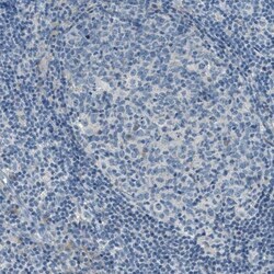 Mesothelin Antibody, Novus Biologicals 25 &mu;L | Buy Online | Novus Biologicals | Fisher Scientific