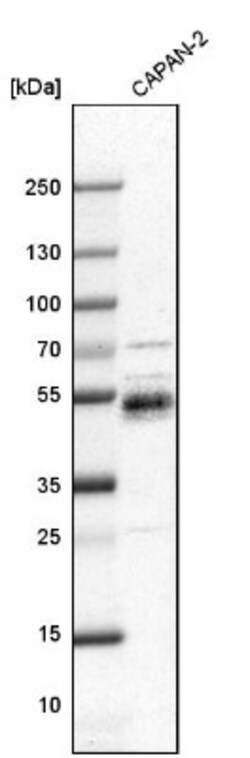 Mesothelin Antibody, Novus Biologicals 25 &mu;L | Buy Online | Novus Biologicals | Fisher Scientific