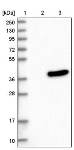 Met-enkephalin Antibody, Novus Biologicals 25 &mu;L | Buy Online | Novus Biologicals | Fisher Scientific