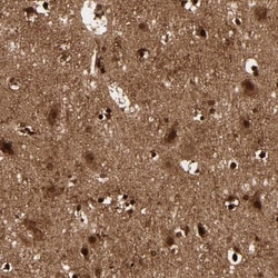 Metallothionein-3 Antibody, Novus Biologicals:Antibodies:Primary Antibodies