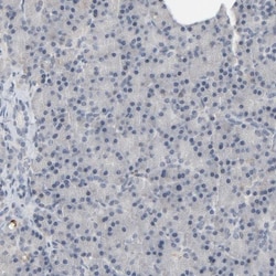 Metallothionein-3 Antibody, Novus Biologicals:Antibodies:Primary Antibodies