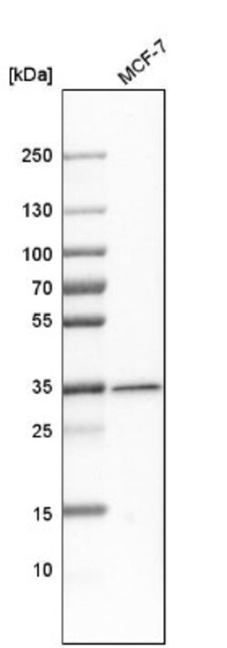 Metaxin 1 Antibody, Novus Biologicals 0.1mL; Unlabeled:Antibodies, Polyclonal