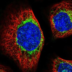 Metaxin-2 Antibody, Novus Biologicals 25 &mu;L; Unlabeled:Antibodies, Polyclonal