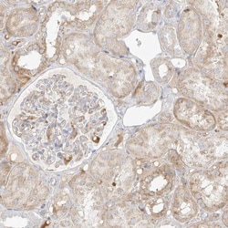 Metaxin-2 Antibody, Novus Biologicals 25 &mu;L; Unlabeled:Antibodies, Polyclonal