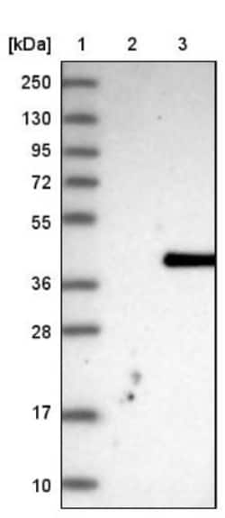 Methionine Aminopeptidase 1D/MAP1D Antibody, Novus Biologicals 25 &mu;L,
