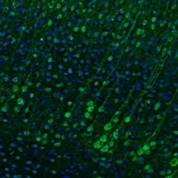 Methionyl tRNA synthetase Antibody, Novus Biologicals 25 &mu;L; Unlabeled:Antibodies,