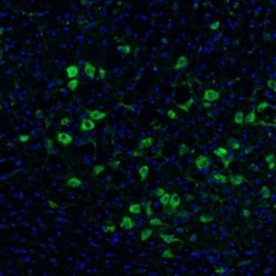 Methionyl tRNA synthetase Antibody, Novus Biologicals 25 &mu;L; Unlabeled:Antibodies,