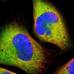 Methionyl tRNA synthetase Antibody, Novus Biologicals 25 &mu;L; Unlabeled:Antibodies,