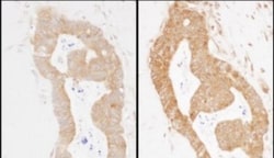 Methionyl tRNA synthetase Antibody, Novus Biologicals 0.1mg; Unlabeled:Antibodies,