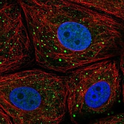 Microseminoprotein, Prostate Associated Antibody, Novus Biologicals 0.1mL;