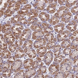 Microsomal Glutathione S-transferase 1 Antibody, Novus Biologicals 25 &mu;L,