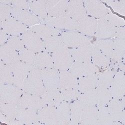Microsomal Glutathione S-transferase 1 Antibody, Novus Biologicals 25 &mu;L,
