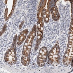 Mrc2 Antibody, Novus Biologicals:Antibodies:Primary Antibodies