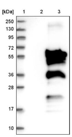 Mrc2 Antibody, Novus Biologicals:Antibodies:Primary Antibodies