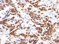 MFG-E8 Antibody (MFG-06), Novus Biologicals 0.2mg; Unlabeled:Antibodies,