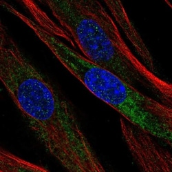 Mimecan/OIF Antibody, Novus Biologicals 25 &mu;L; Unlabeled:Antibodies,