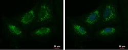 Mitochondrial ribonuclease P protein 3 Antibody, Novus Biologicals 0.1mL;