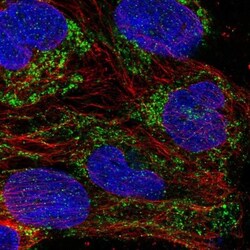 Mitochondrial ribosomal protein L11 Antibody, Novus Biologicals:Antibodies:Primary