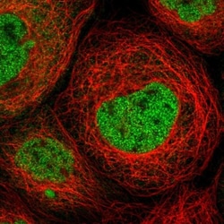 Mkl1 Antibody, Novus Biologicals 0.1mL; Unlabeled:Antibodies, Polyclonal