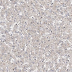 Mkl1 Antibody, Novus Biologicals 0.1mL; Unlabeled:Antibodies, Polyclonal