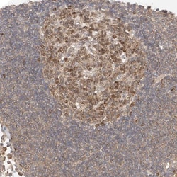 Mkl1 Antibody, Novus Biologicals 0.1mL; Unlabeled:Antibodies, Polyclonal