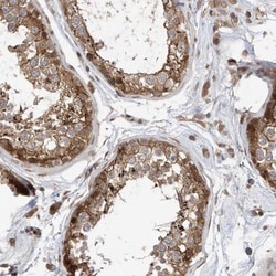 Mkl1 Antibody, Novus Biologicals 0.1mL; Unlabeled:Antibodies, Polyclonal