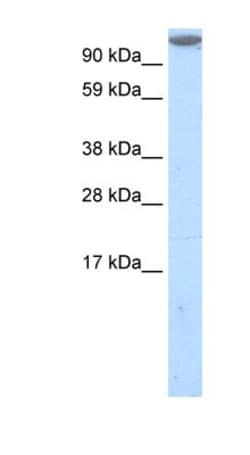 Mkl1 Antibody, Novus Biologicals 100 ul; Unconjugated:Antibodies, Polyclonal
