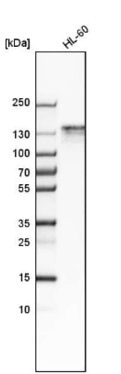Mkl1 Antibody, Novus Biologicals 0.1mL; Unlabeled:Antibodies, Polyclonal