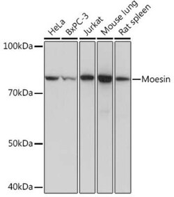 Moesin Rabbit anti-Human, Mouse, Rat, Clone: 6G0N7, Novus Biologicals:Antibodies:Primary