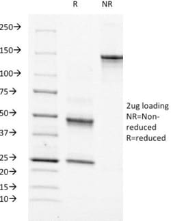 Moesin Mouse anti-Human, Rat, Clone: MSN/491, Novus Biologicals:Antibodies:Primary