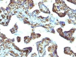 Moesin Antibody (MSN/493), Novus Biologicals 0.2mg; Unlabeled:Antibodies,