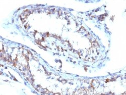 Moesin Antibody (MSN/493), Novus Biologicals 0.2mg; Unlabeled:Antibodies,