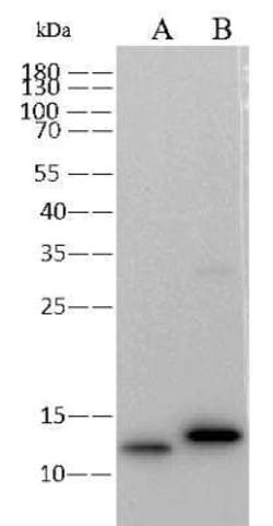 Monkeypox Virus A29L Antibody (0027), Novus Biologicals 100 &mu;g; Unconjugated:Antibodies,