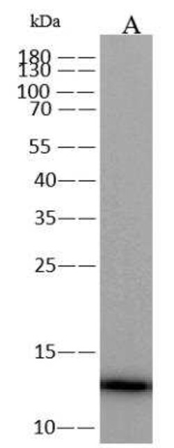 Monkeypox Virus A29L Antibody (0031), Novus Biologicals 100 &mu;g; Unconjugated:Antibodies,