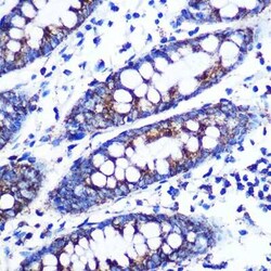 Monoamine Oxidase B Rabbit anti-Human, Mouse, Rat, Clone: 5M8A5, Novus Biologicals 20 &mu;g | Buy Online | Novus Biologicals | Fisher Scientific